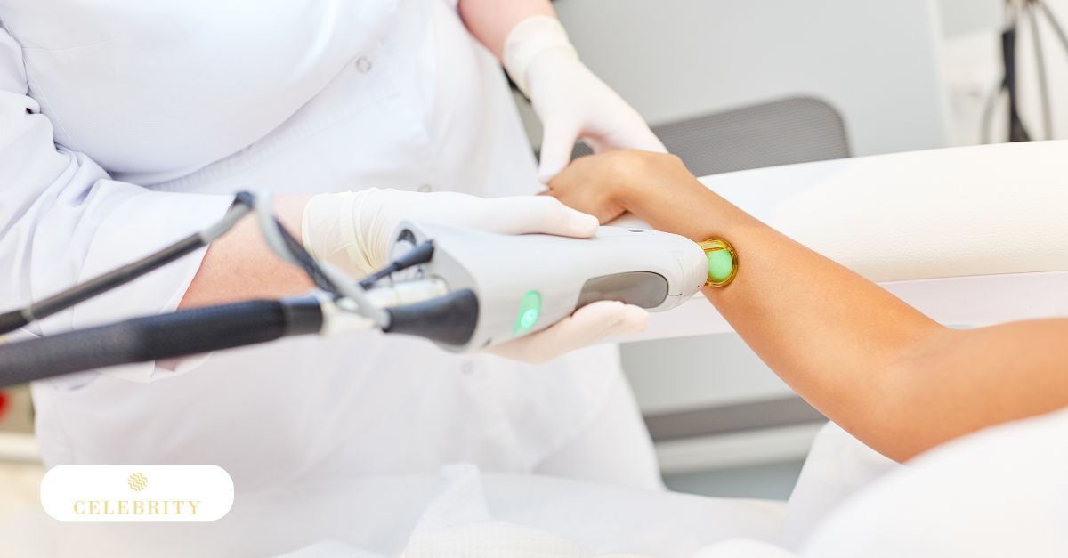 Women with different skin tones, showcasing various skin tones and hair colors for laser hair removal options