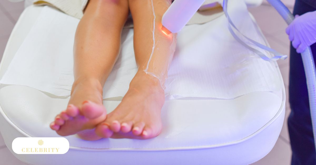 A woman receiving laser hair removal on her leg after preparing her skin for laser hair removal session