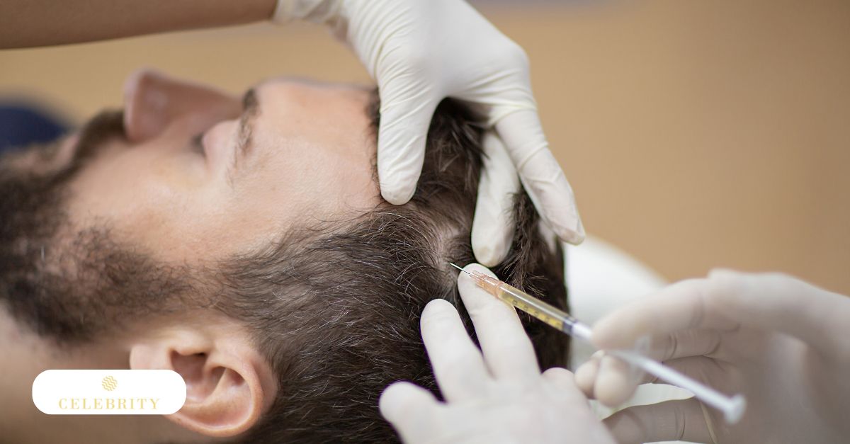 PRP injection being administered into the scalp for hair restoration treatment