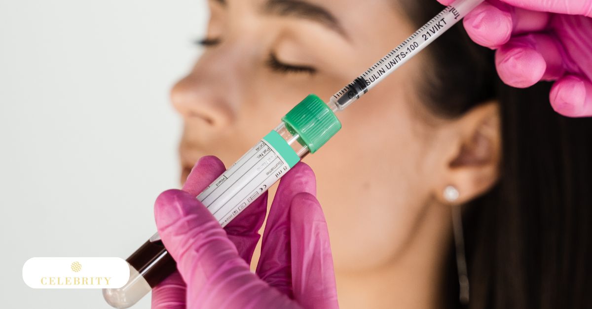 Platelet-rich plasma syringe used for PRP treatment with patient in background