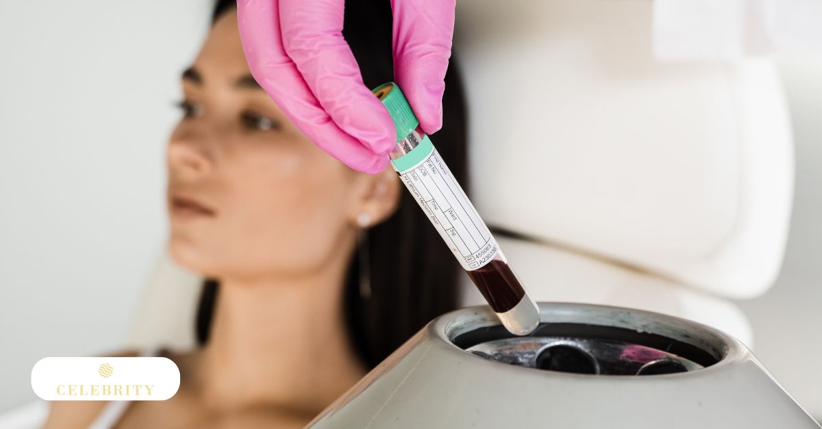 Preparation stage of PRP therapy with centrifuged blood being collected for injection