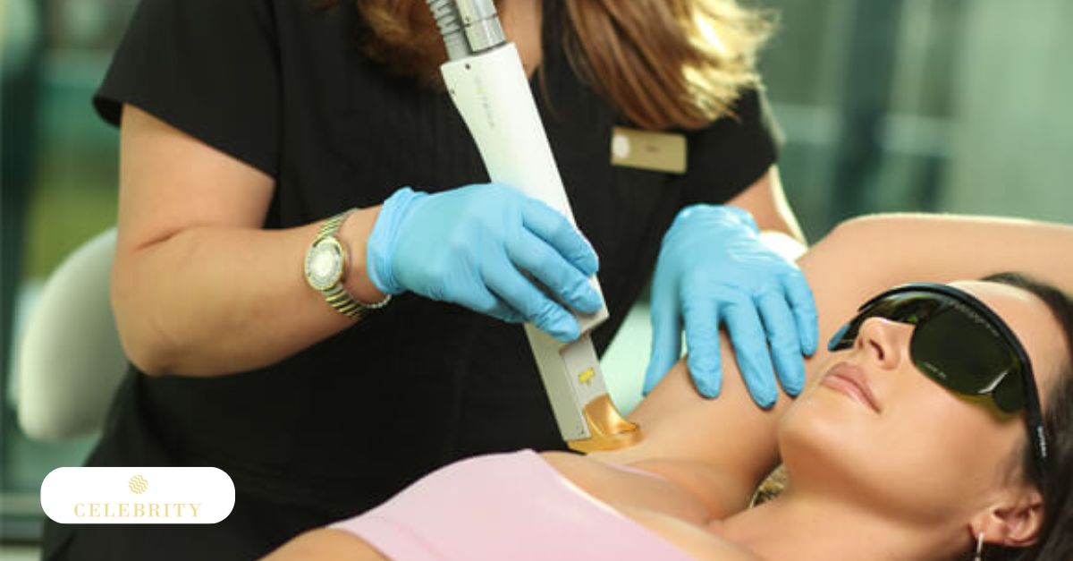 A woman undergoing laser hair removal at Celebrity Laser & Skin Care