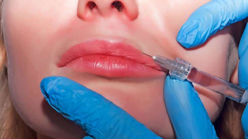 Injection for full lips