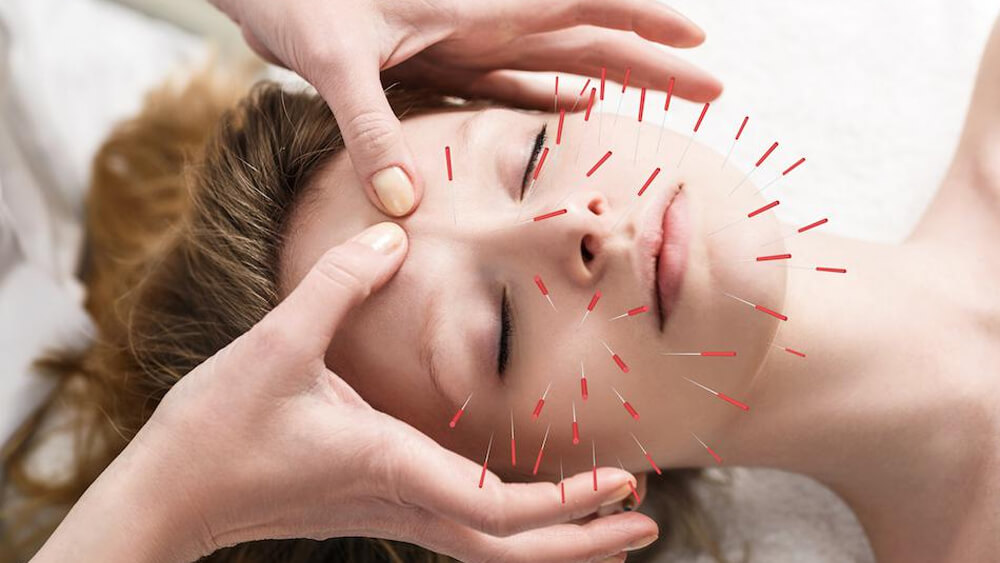 a woman is doing cosmetic acupuncture on face