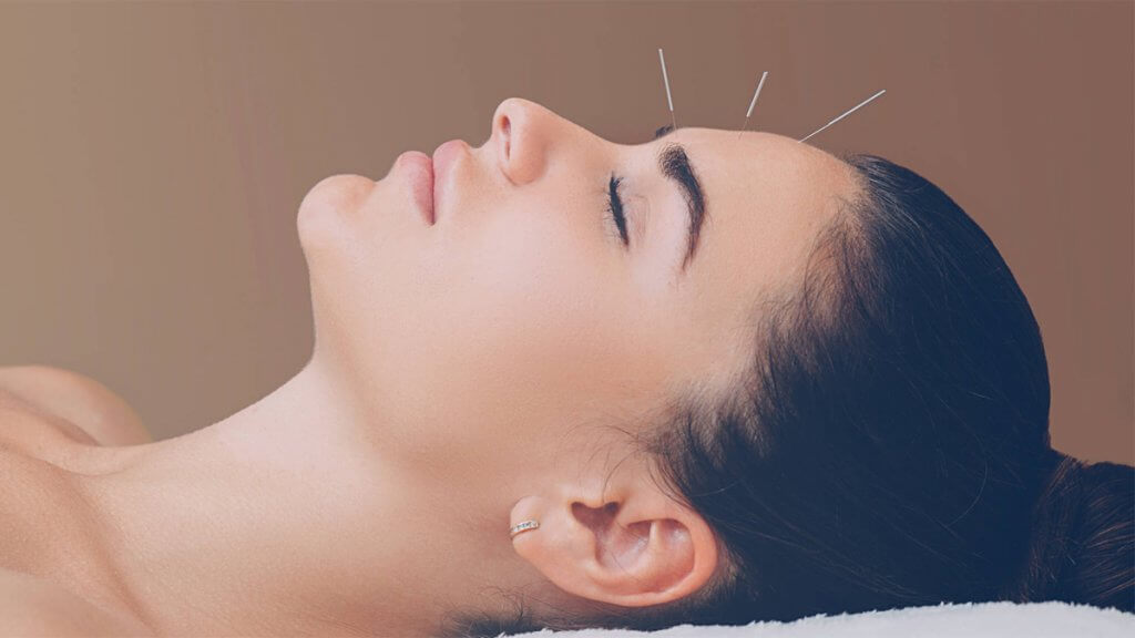 is cosmetic acupuncture the new Botox