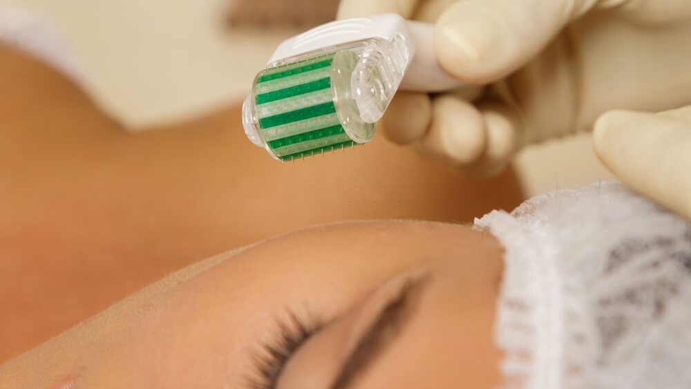 Woman in beauty salon during microneedling