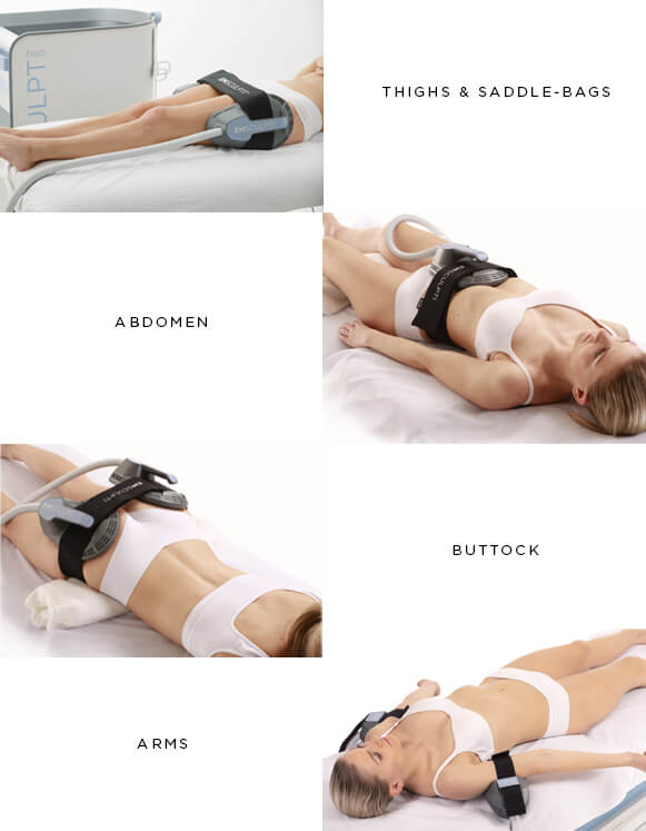 Emsculpt Neo body shaping Emsculpt Neo body shaping