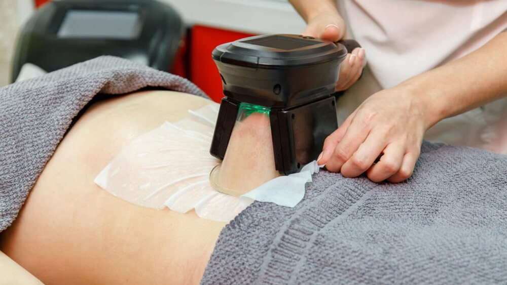 Beauty therapist applying Coolsculpting