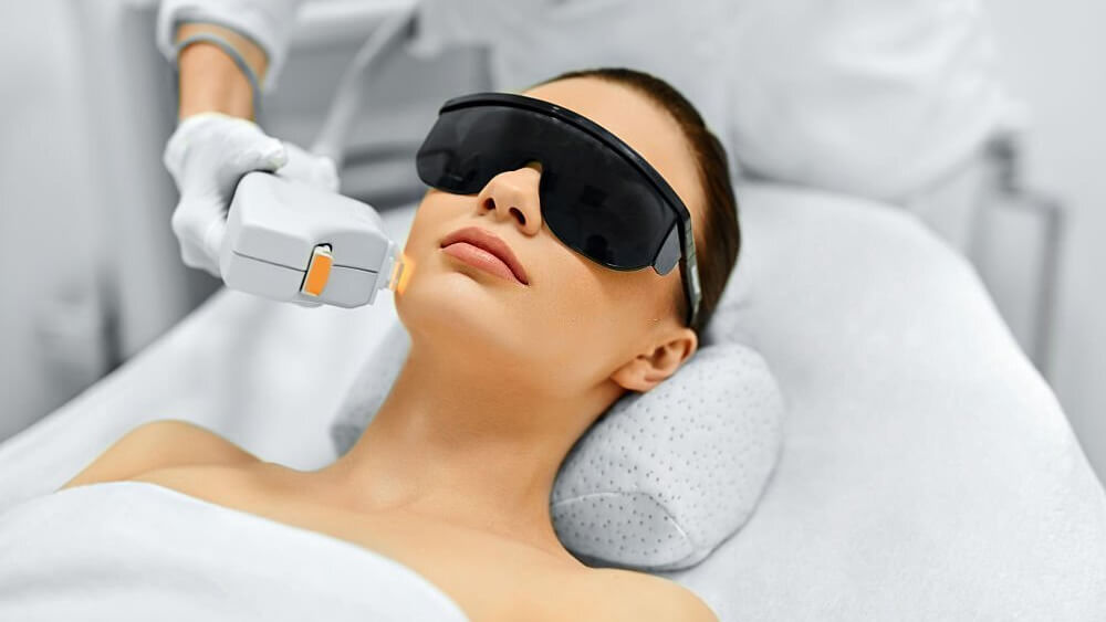 Face beauty treatment using laser