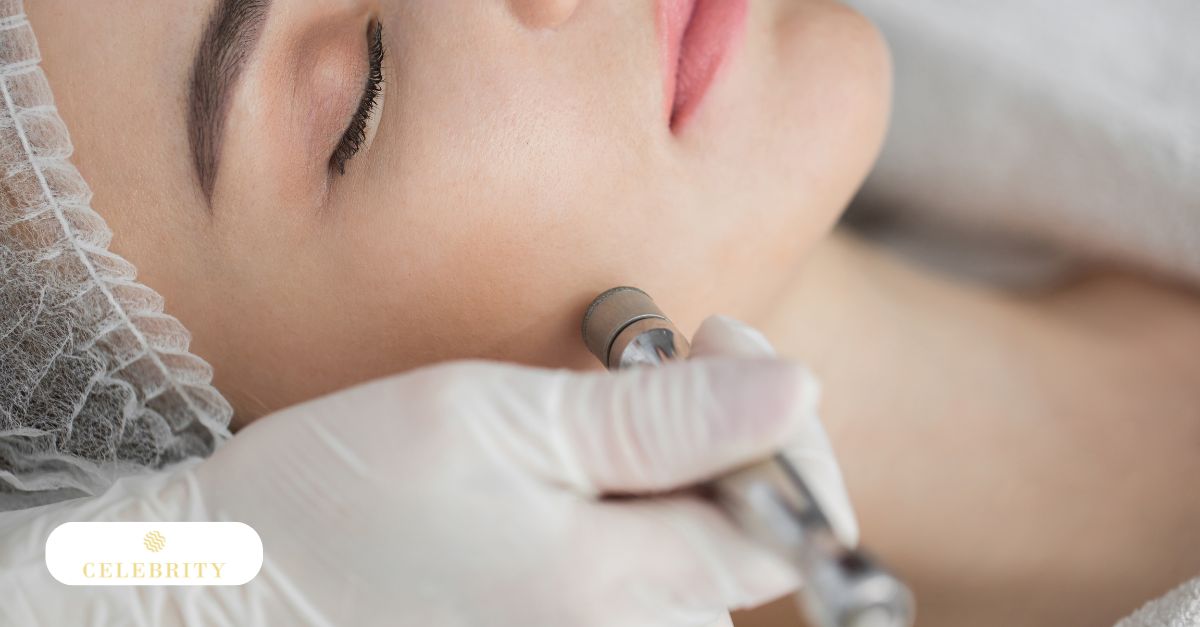An aesthetician uses a diamond-tip wand for microdermabrasion, a treatment for freckles and brown spots, to improve skin texture and tone.