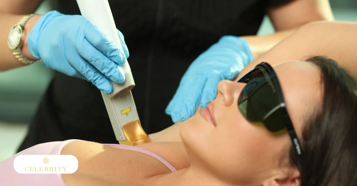 Woman undergoing laser hair removal at Celebrity Laser Skin & Care for her underarms