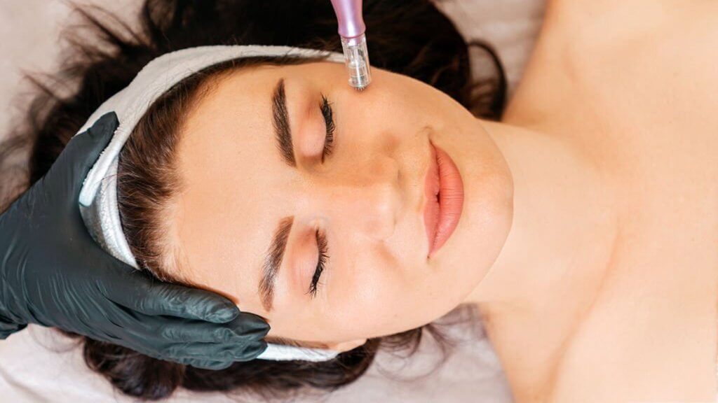 Professional skin care and beauty treatment doing microneedling