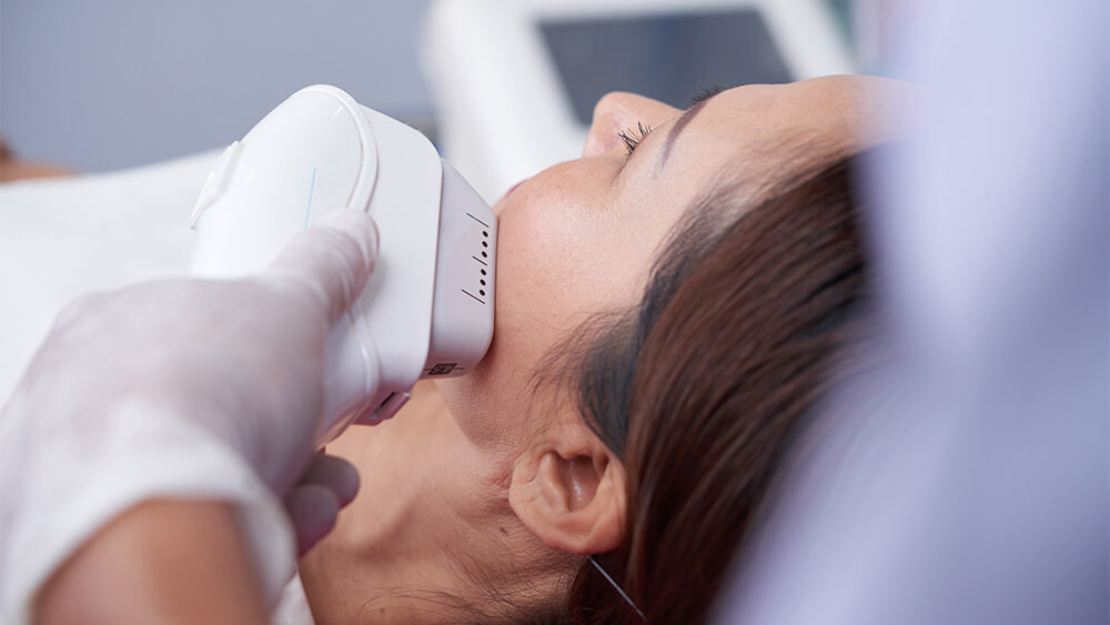 Laser hair removal procedure getting done on a woman's face