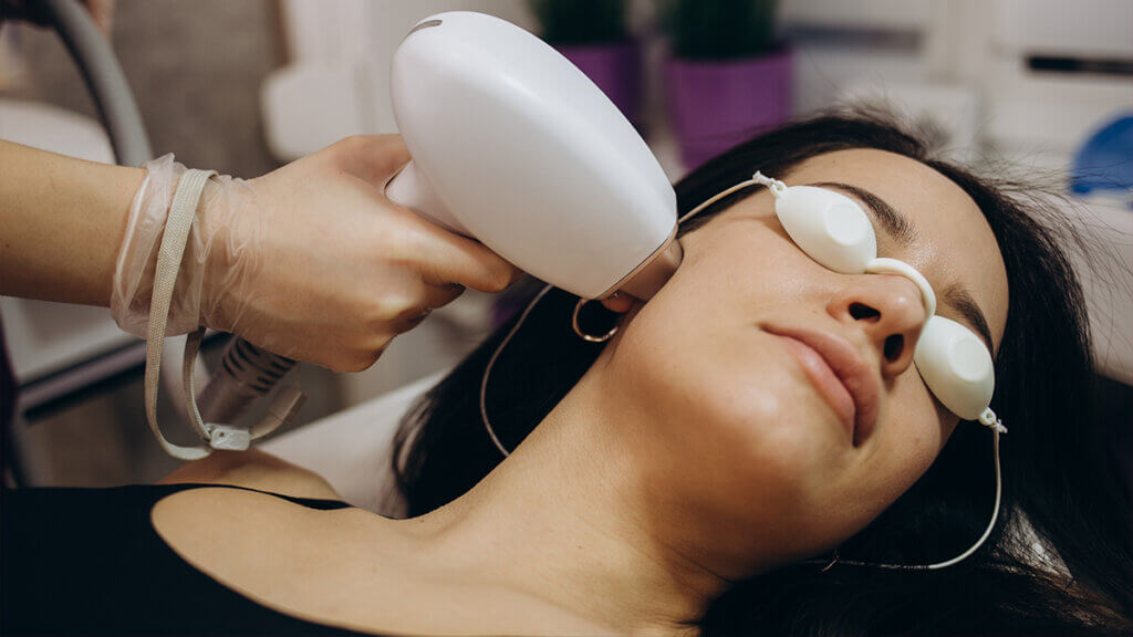 Skincare process using IPL treatment on a young woman face