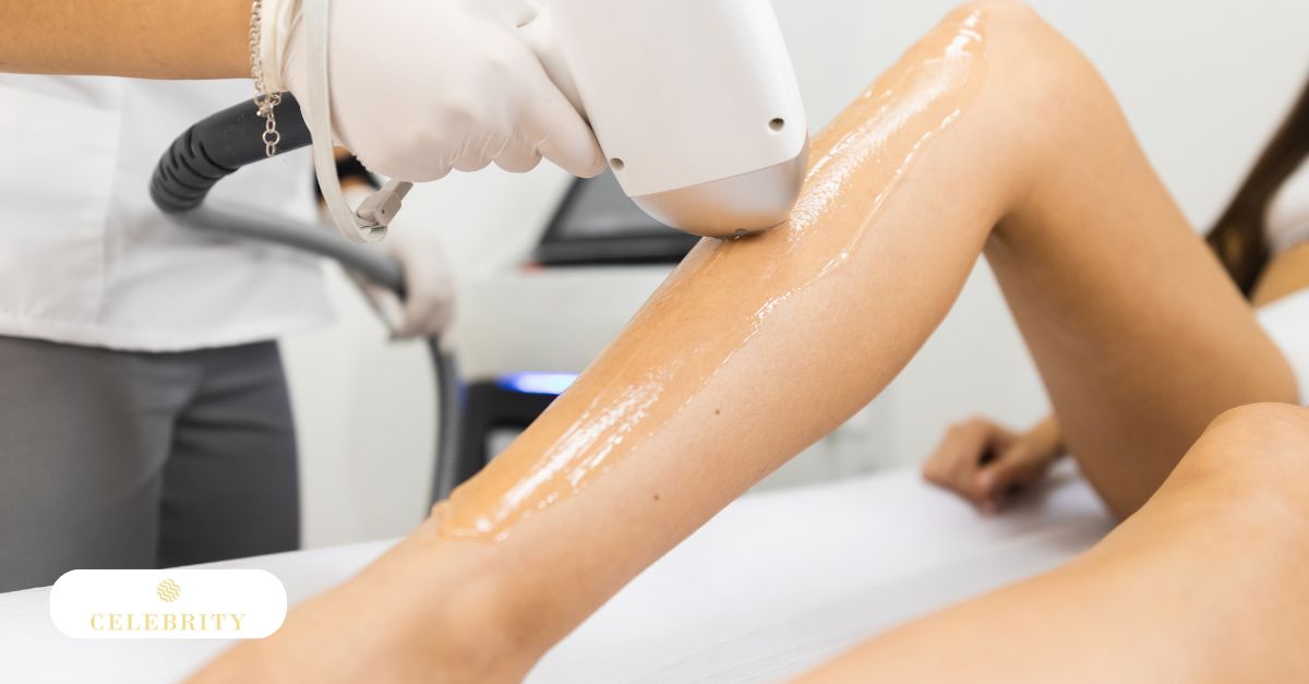 A woman receiving an IPL laser treatment on her face at Celebrity Laser & Skin Care clinic