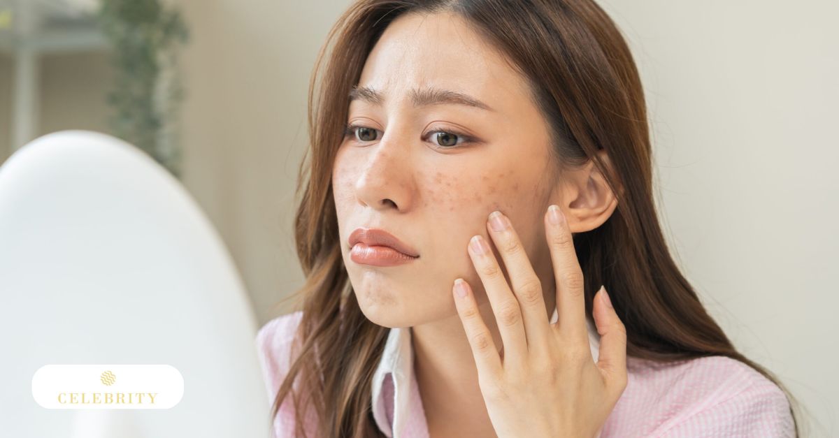 Close-up of a person examining their facial skin and freckles in a white-framed mirror.