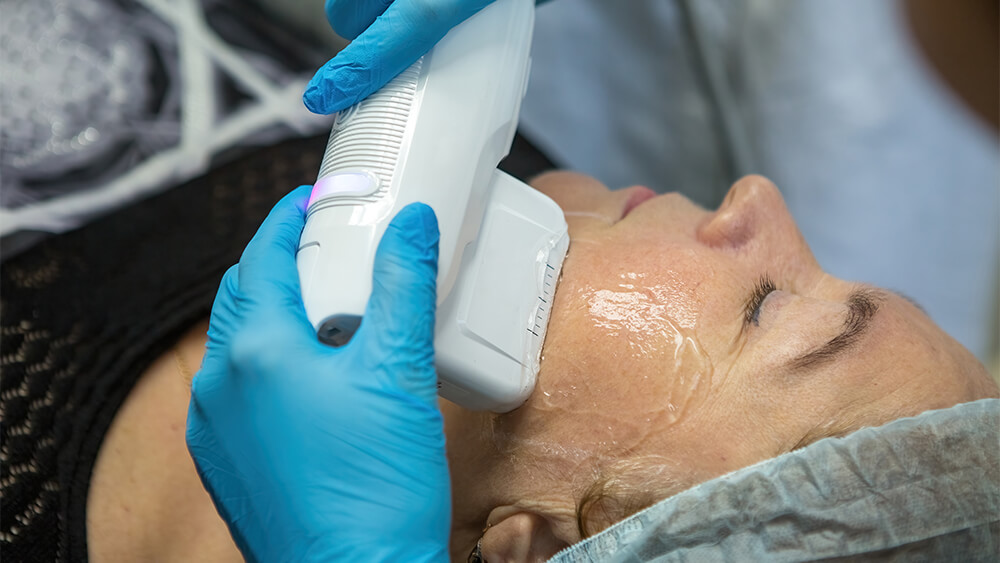 SMAS lifting and rejuvenation of an elderly woman with IPL