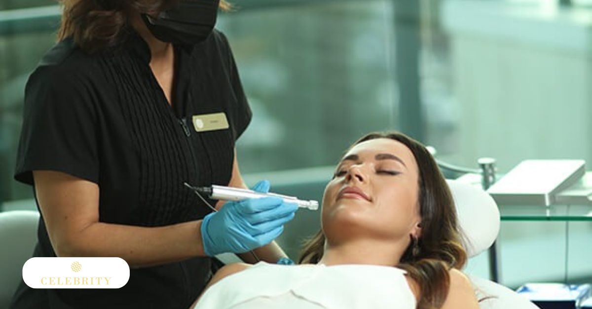 Woman undegoing microneedling treatment at Celebrity Laser & Skin Care