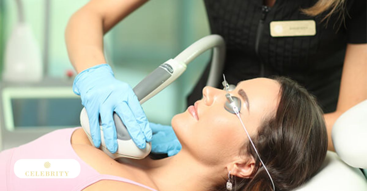Woman undergoing LimeLight IPL at Celebrity Laser & Skin Care