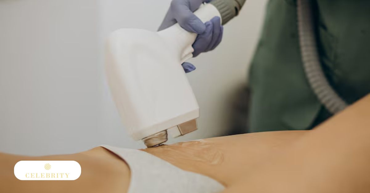 A technician using a medical-grade laser device on a client's abdomen to manage hair regrowth.