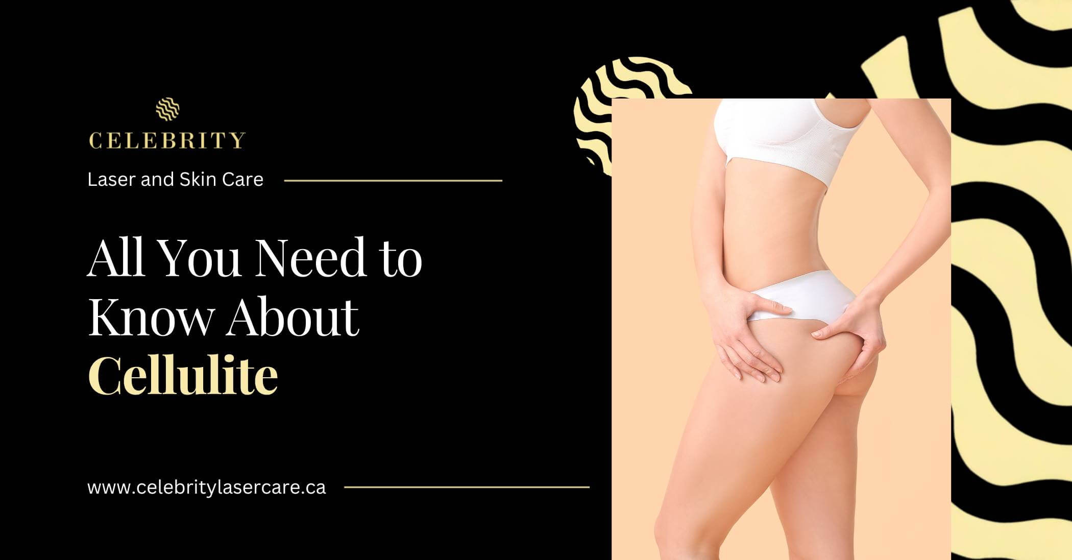 All You Need to Know About Cellulite