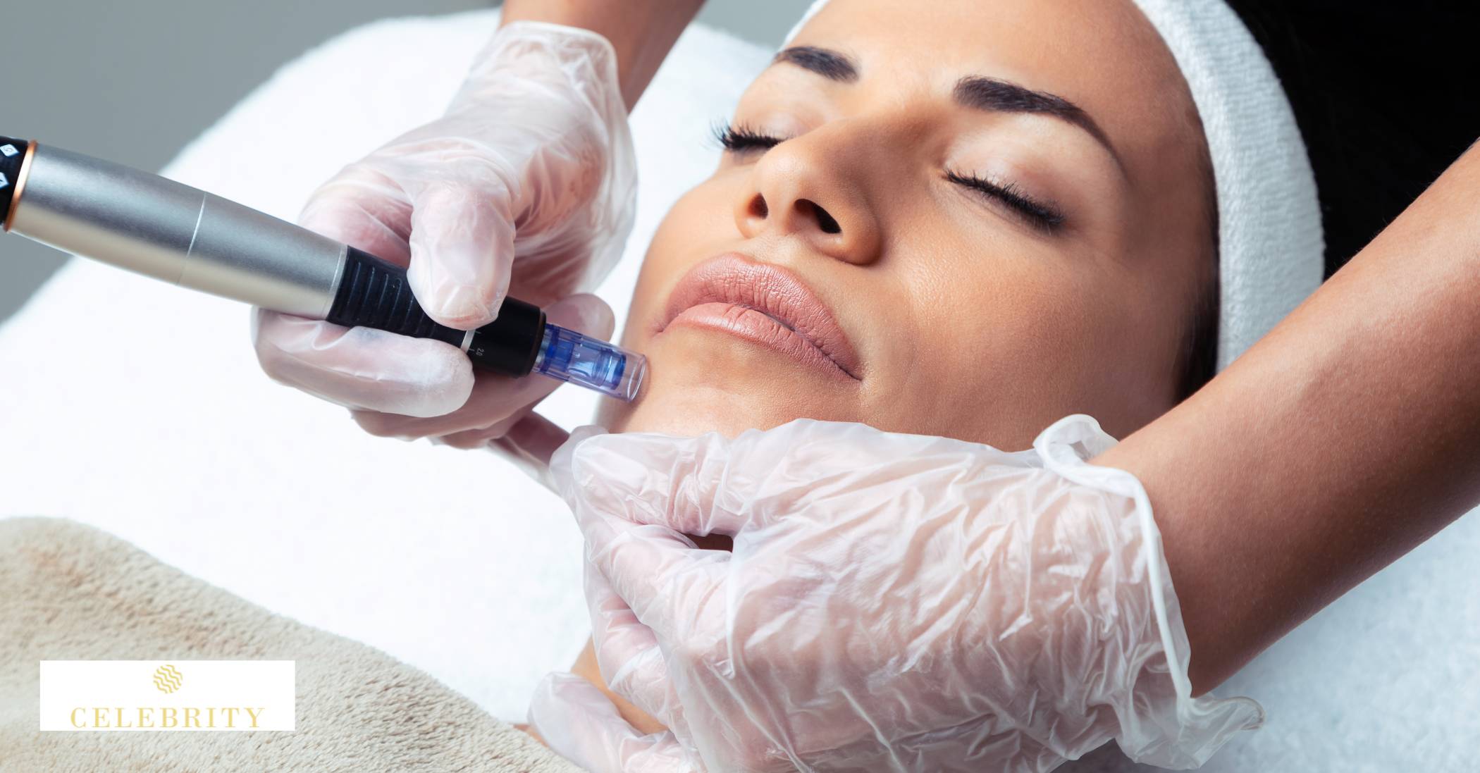 Benefits of Microneedling