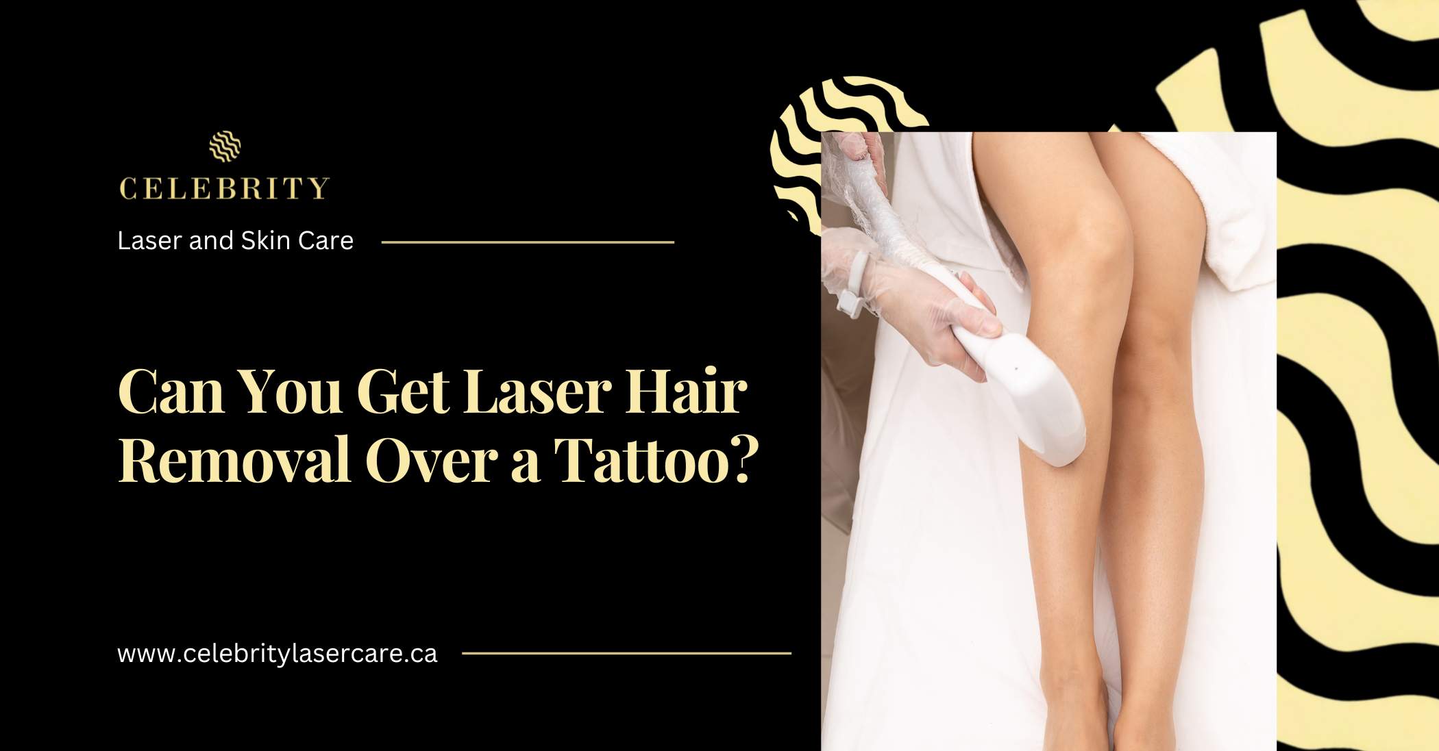 can you get laser hair removal over a tattoo