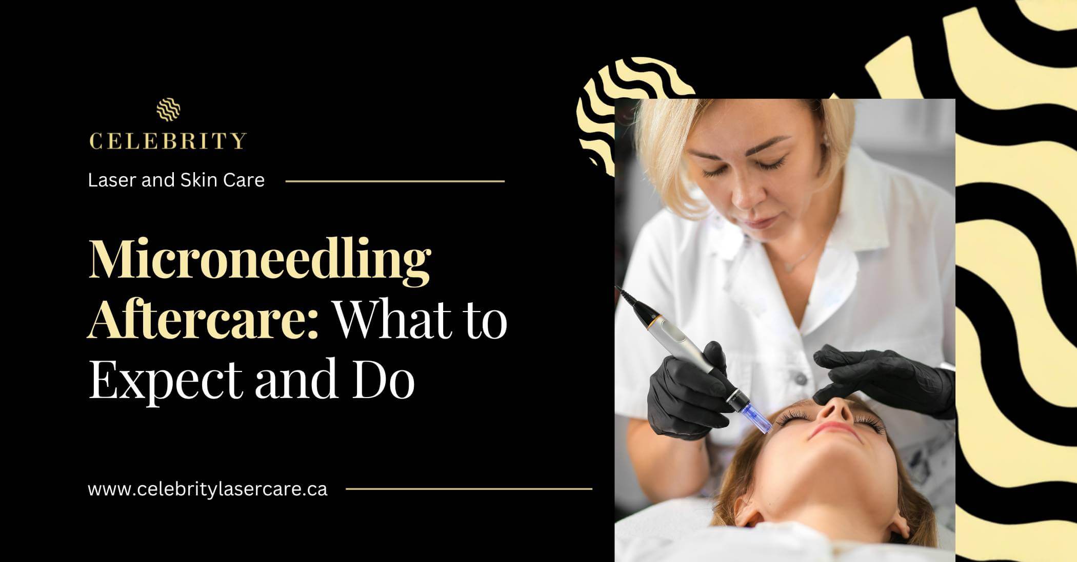 Microneedling Aftercare