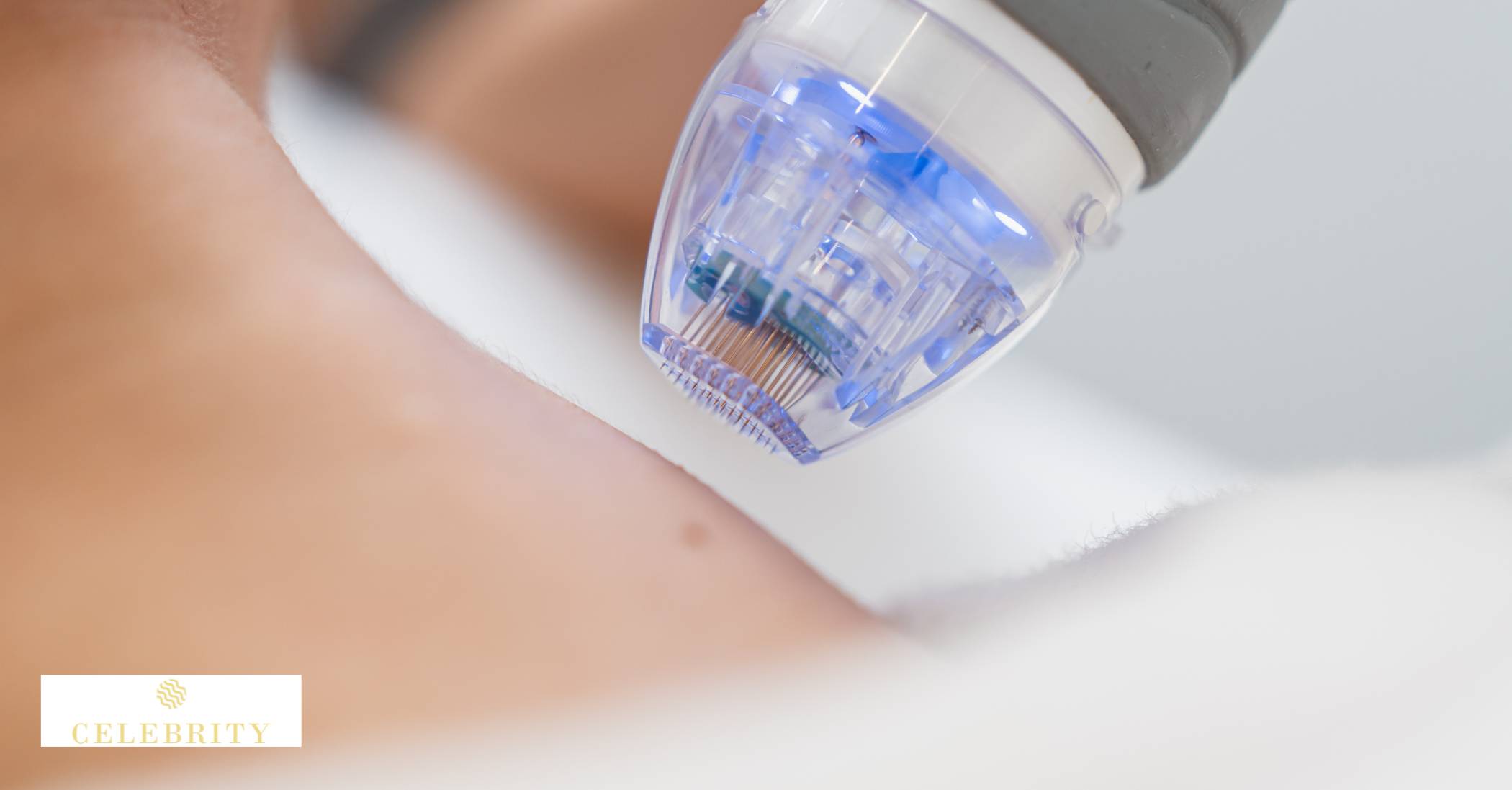 Microneedling Procedure Details