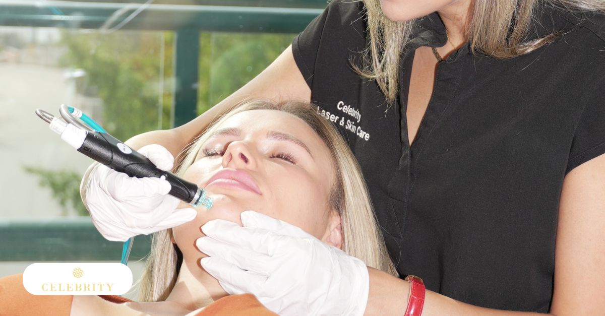 HydraFacial treatment at Celebrity Laser & Skin Care  showing deep cleansing, exfoliation, and hydration benefits