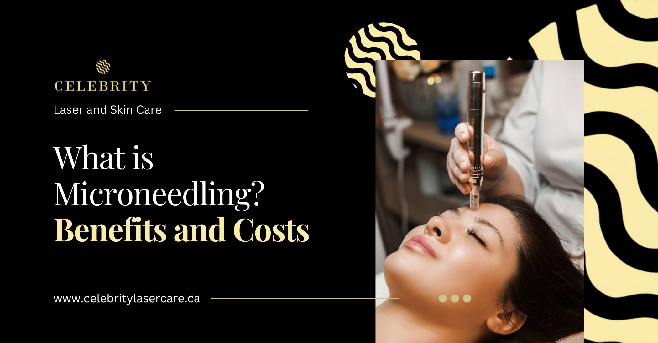 What is Microneedling? Benefits and Costs