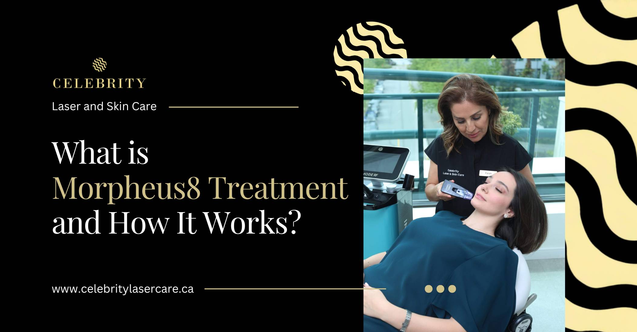 What is Morpheus8 Treatment and How It Works