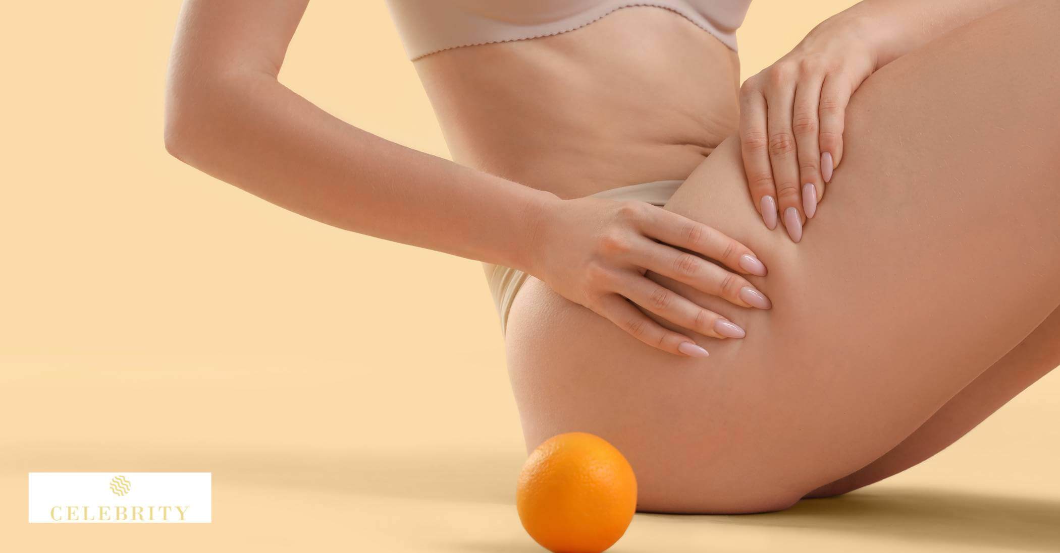 What is the Cause of Cellulite