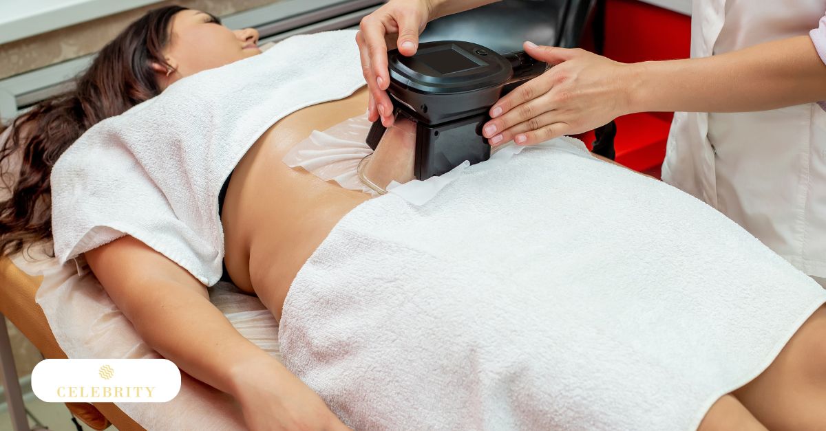 A specialist performing Cryolipolysis (CoolSculpting) on a patient's abdomen to help contour the body without surgery in a professional clinical setting.