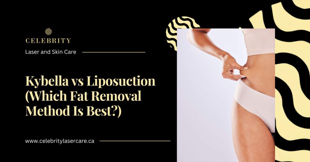 Kybella vs Liposuction