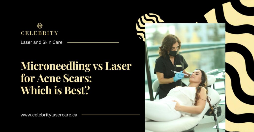 Microneedling vs Laser for Acne Scars