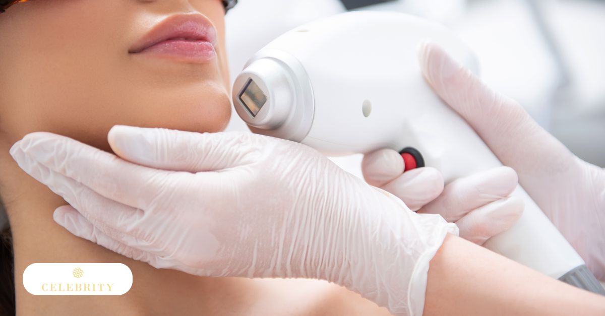 Clinician performing facial laser hair removal on patient’s chin using handheld device and protective gloves