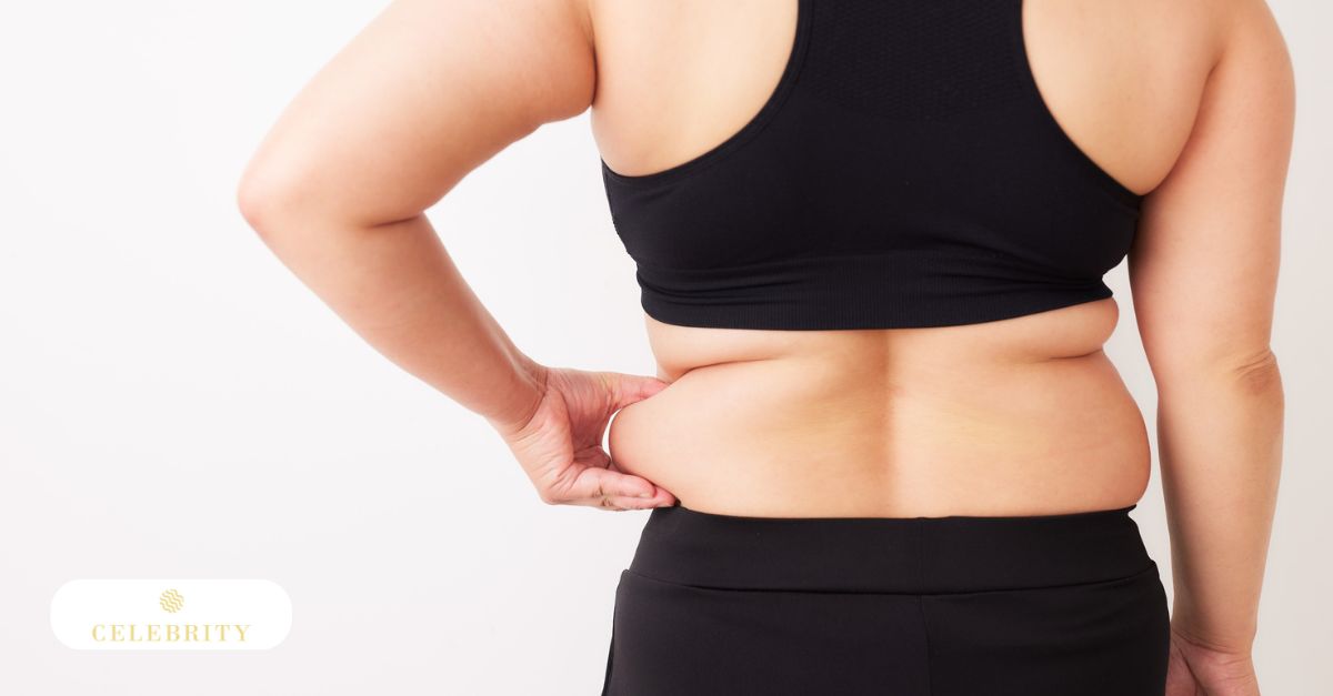 A close-up of a person's midsection and waist, showing the type of localized fat that determines who is a good candidate for body sculpting procedures.