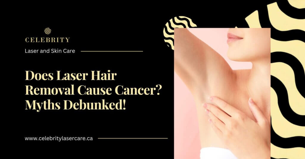 Does Laser Hair Removal Cause Cancer