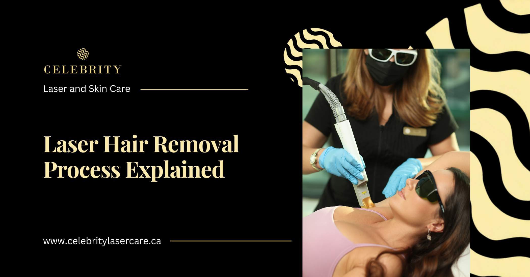 The Science of Laser Hair Removal