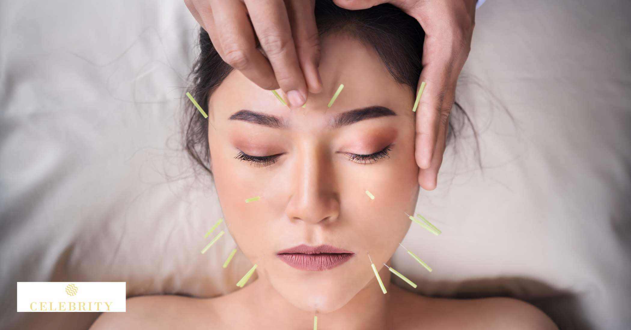 Integrating facial acupuncture and microneedling