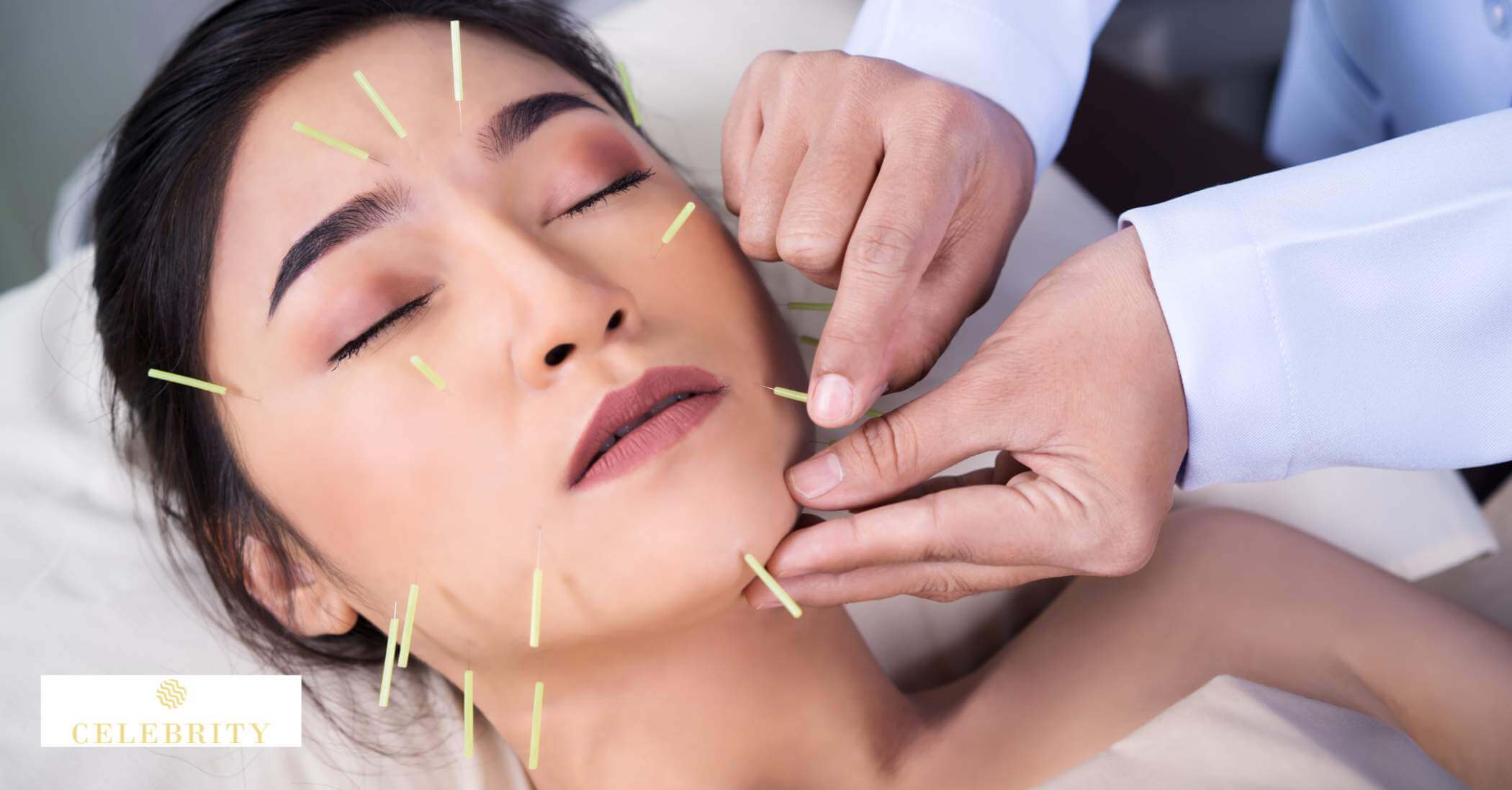 Effective combination of acupuncture and aesthetic treatments