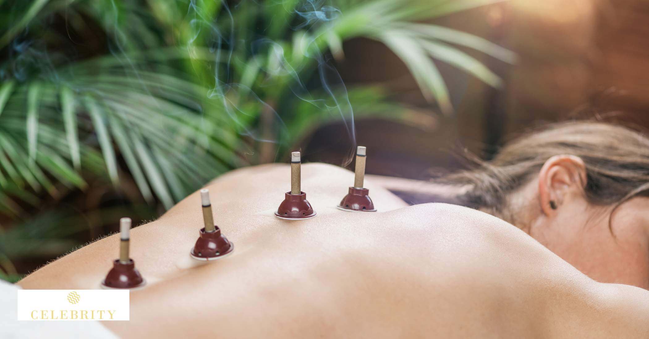 A woman in an acupuncture session, utilizing moxibustion.