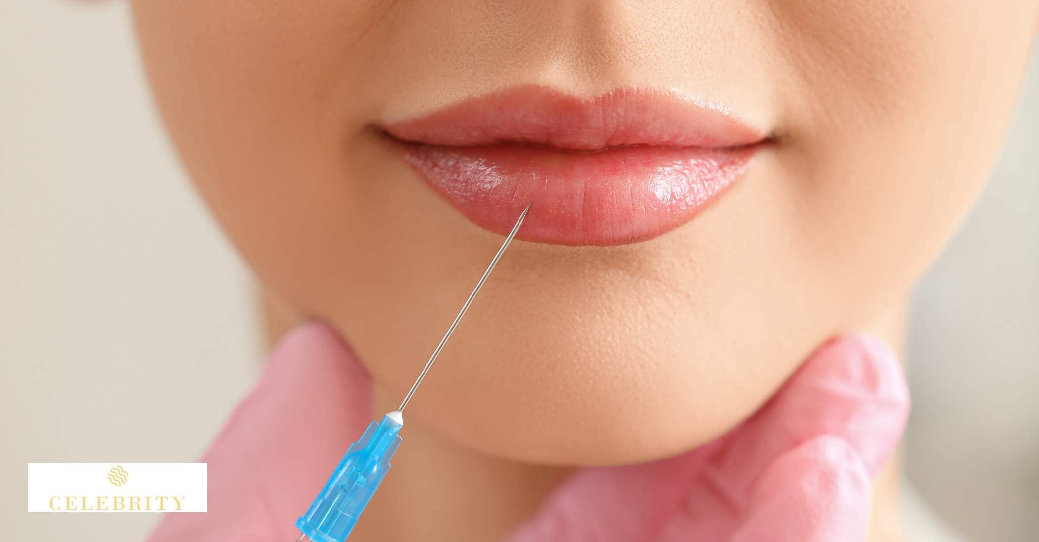 Which filler type is best for lip augmentation