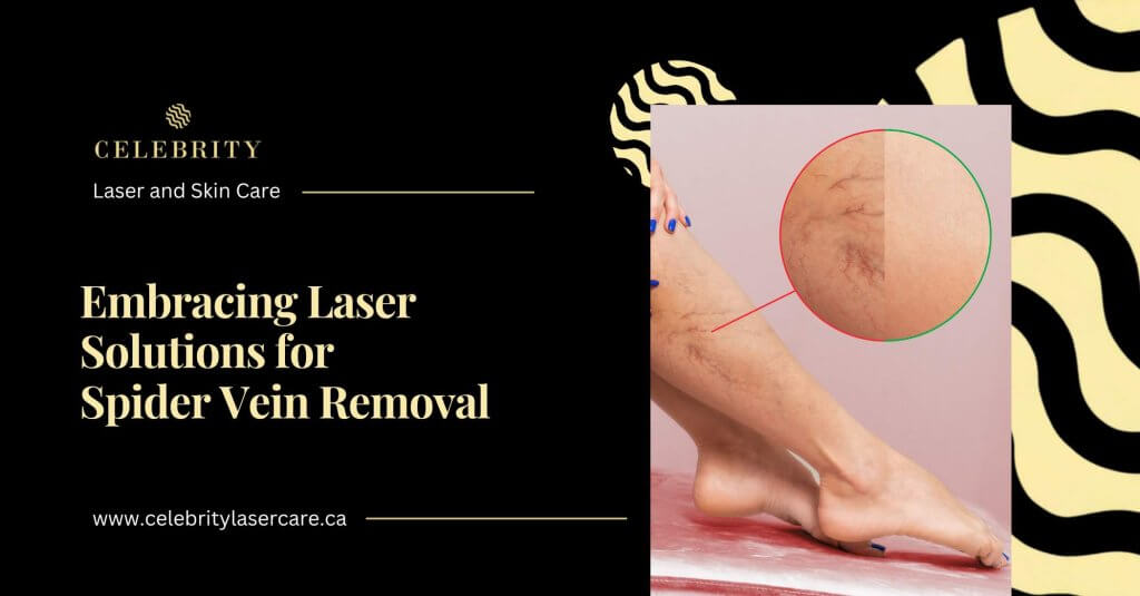 Laser Therapy for Spider Veins: Benefits, Treatment & Results