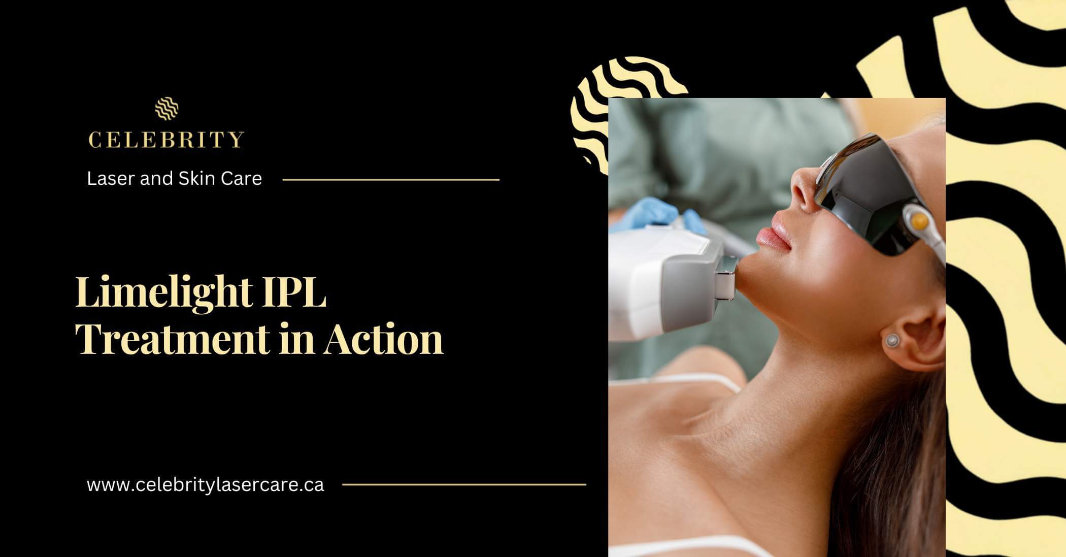 How Limelight IPL Targets Pigmentation