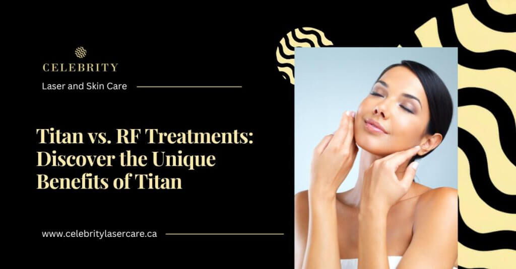 Comparing Titan and Other RF Skin Tightening Treatments