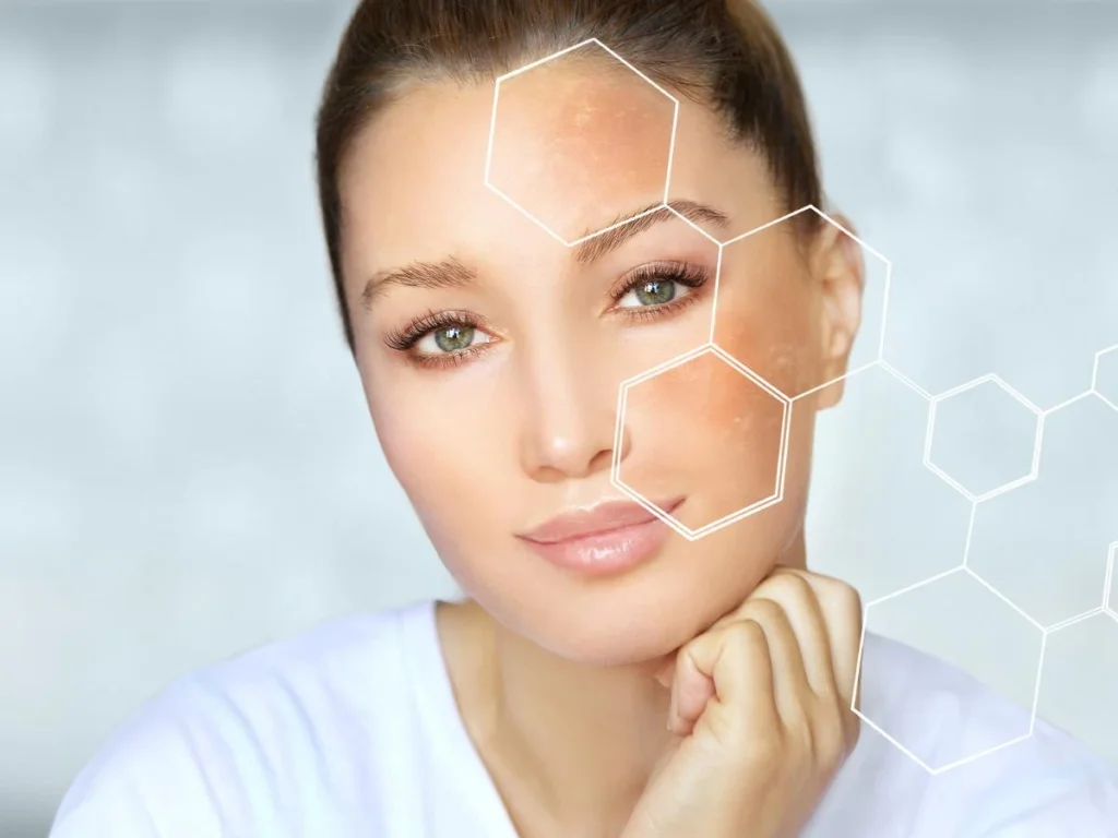 How to Identify & Treat Dull Skin Effectively