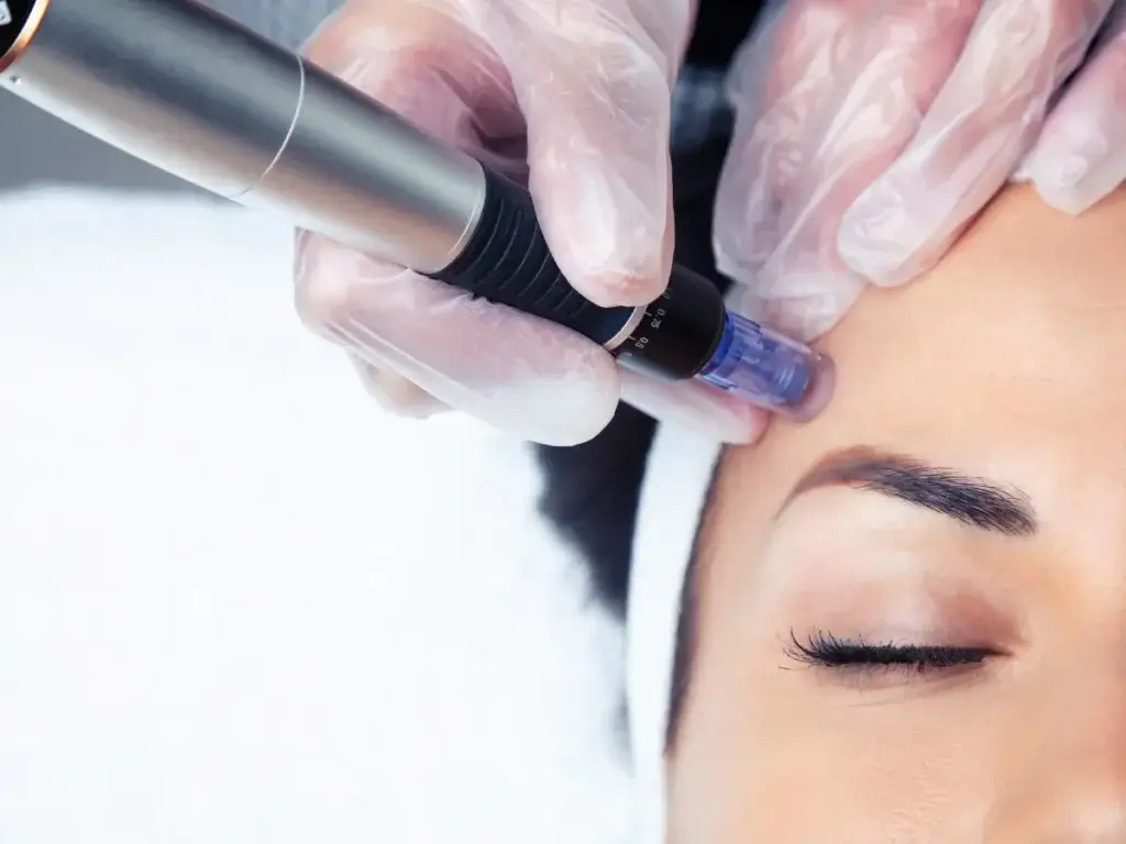 Refine Your Skin - Pore Reduction Treatments That Work