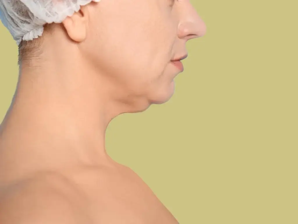 What Causes a Double Chin & How to Treat It?